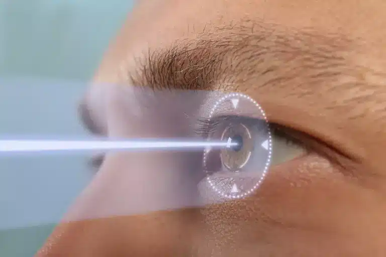 lasik