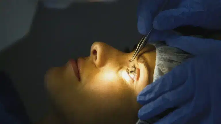 lasik5