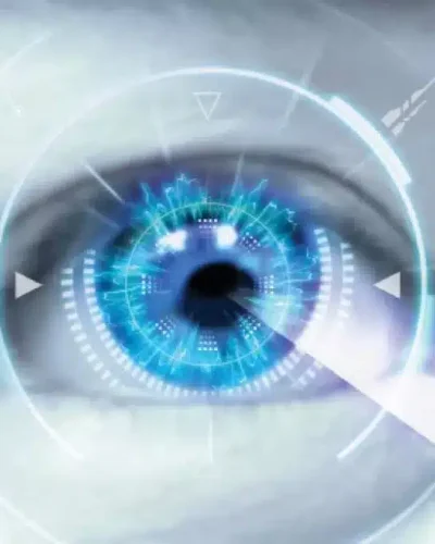 Intralasik-lasik-1024x683.jpg