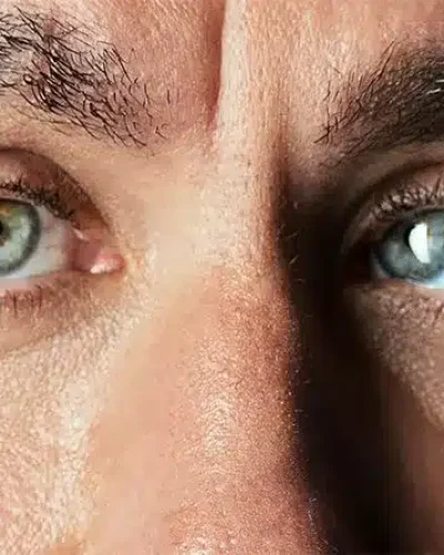 eye-squint-web-image-1