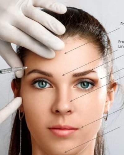 xeomin-treatment